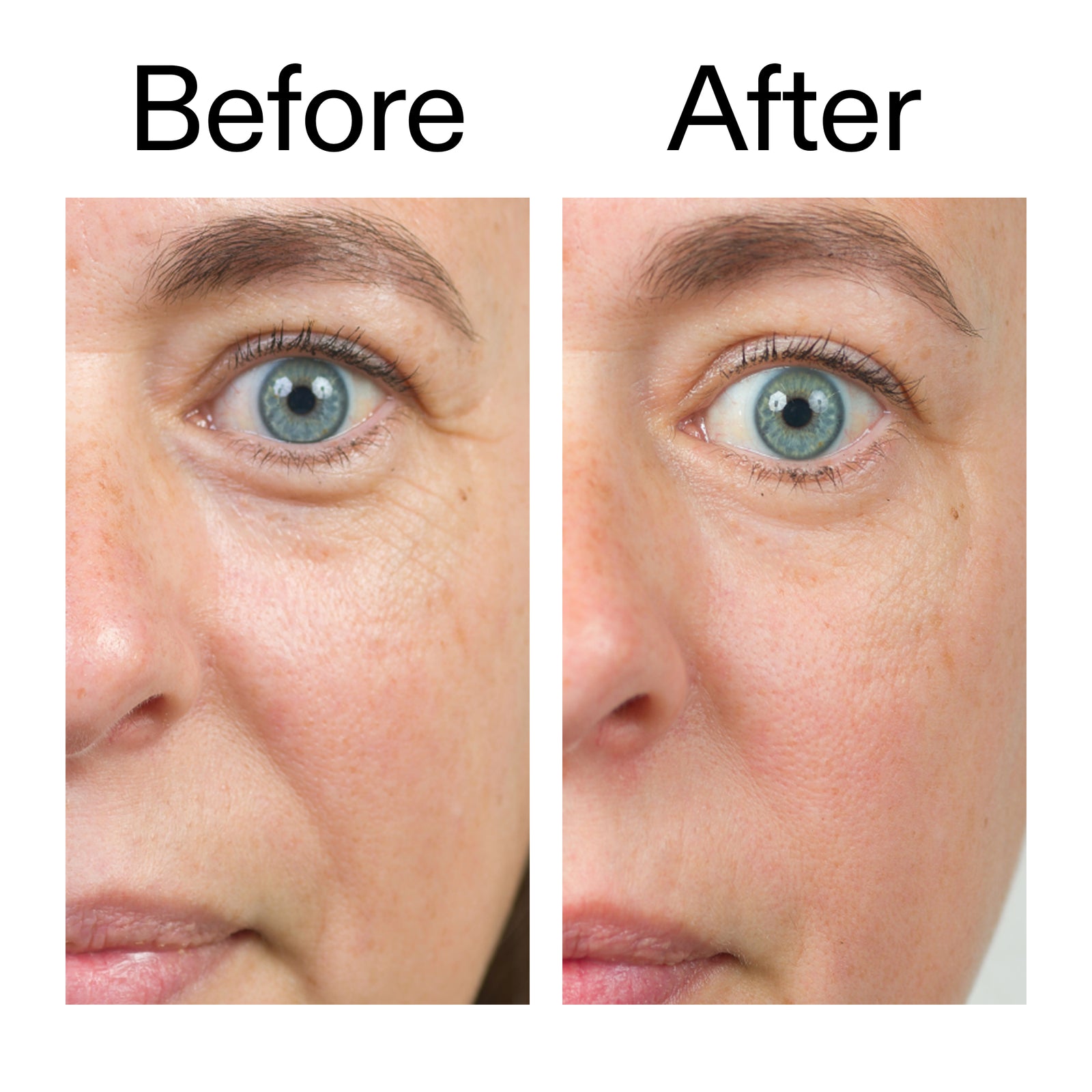 Before and after of customer using  BioActive Moisturizer