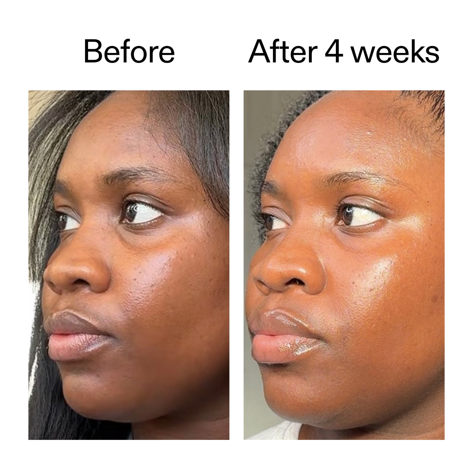 Before and after comparison of a woman's face with text indicating time elapsed.