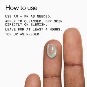 Text on how to use Succinic Acid Treatment with a close-up of a finger applying it.