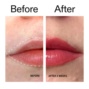 Before and after comparison of lips with a product application, showing a visible improvement.
