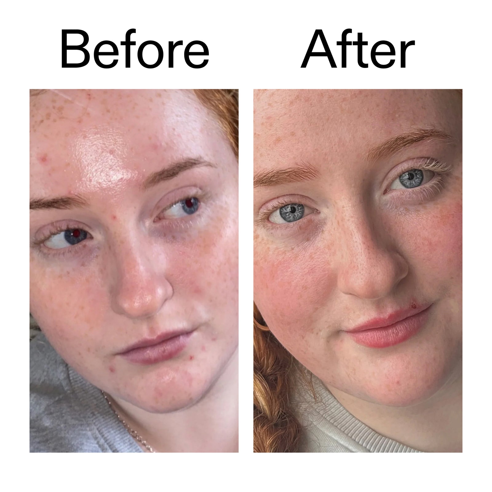 Before and after comparison of a person's face with visible improvements.