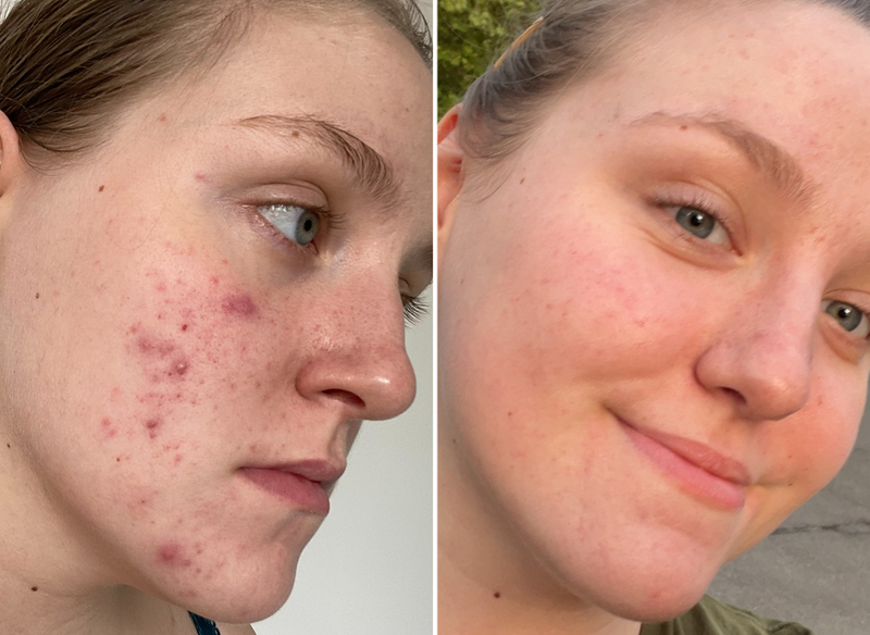Customer before and after results side by side