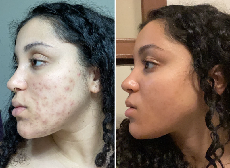 Customer before and after results