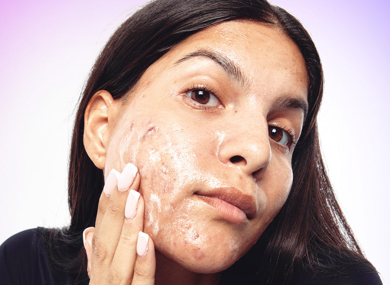 Model cleansing with Salicylic Acid 