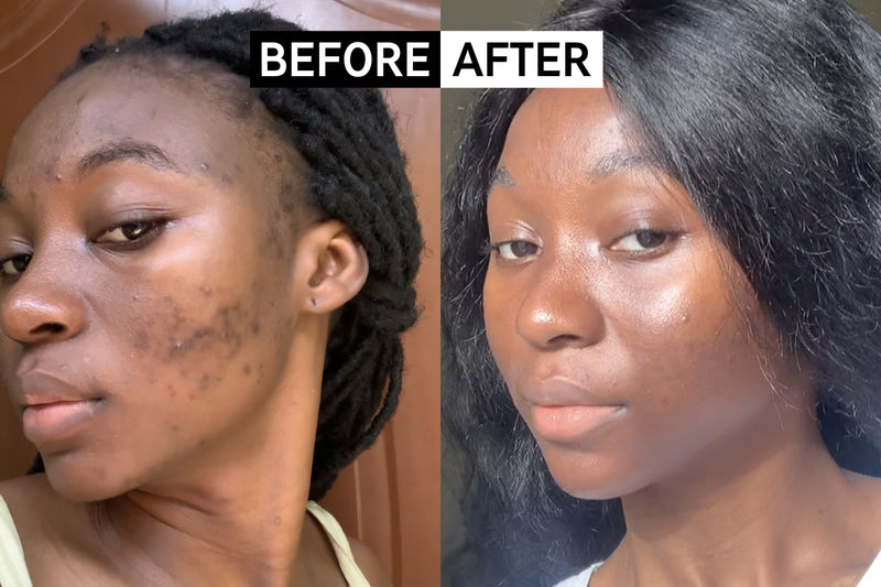 Customer using The INKEY List as part of their skincare routine