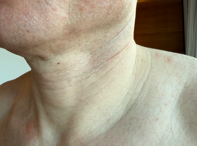 man's neck