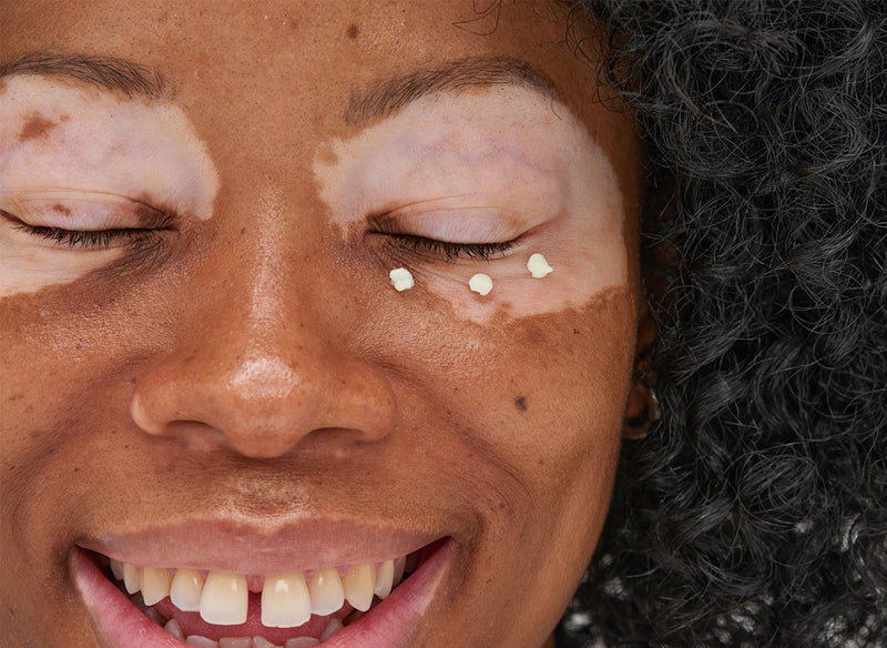 Model with eye cream under her eyes