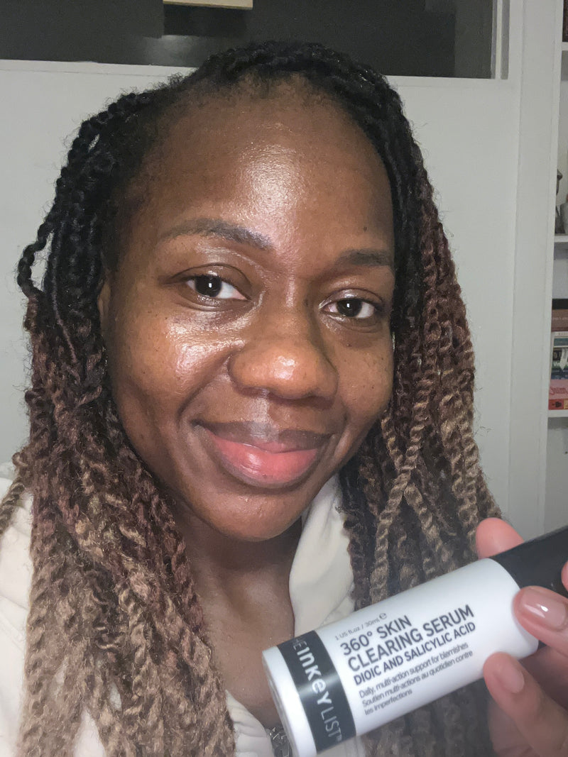 A woman holds a white and black tube of 360° Skin Clearing Serum in front of her face, showing the product packaging in a close-up selfie-style shot.