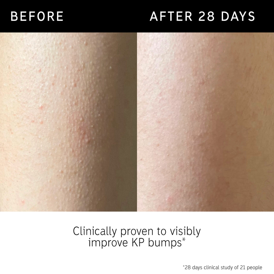 Peeling-Körper-Stick mit Glykolsäure | The INKEY List