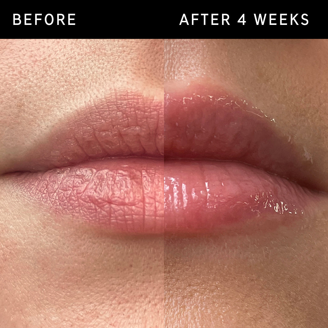 Two images of a pair of lips, put side by side to show the different after using Tripeptide Plumping Lip Balm for 2 weeks.