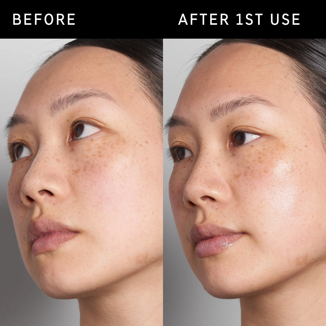 Before and after side by side from results using Hyaluronic Acid Serum