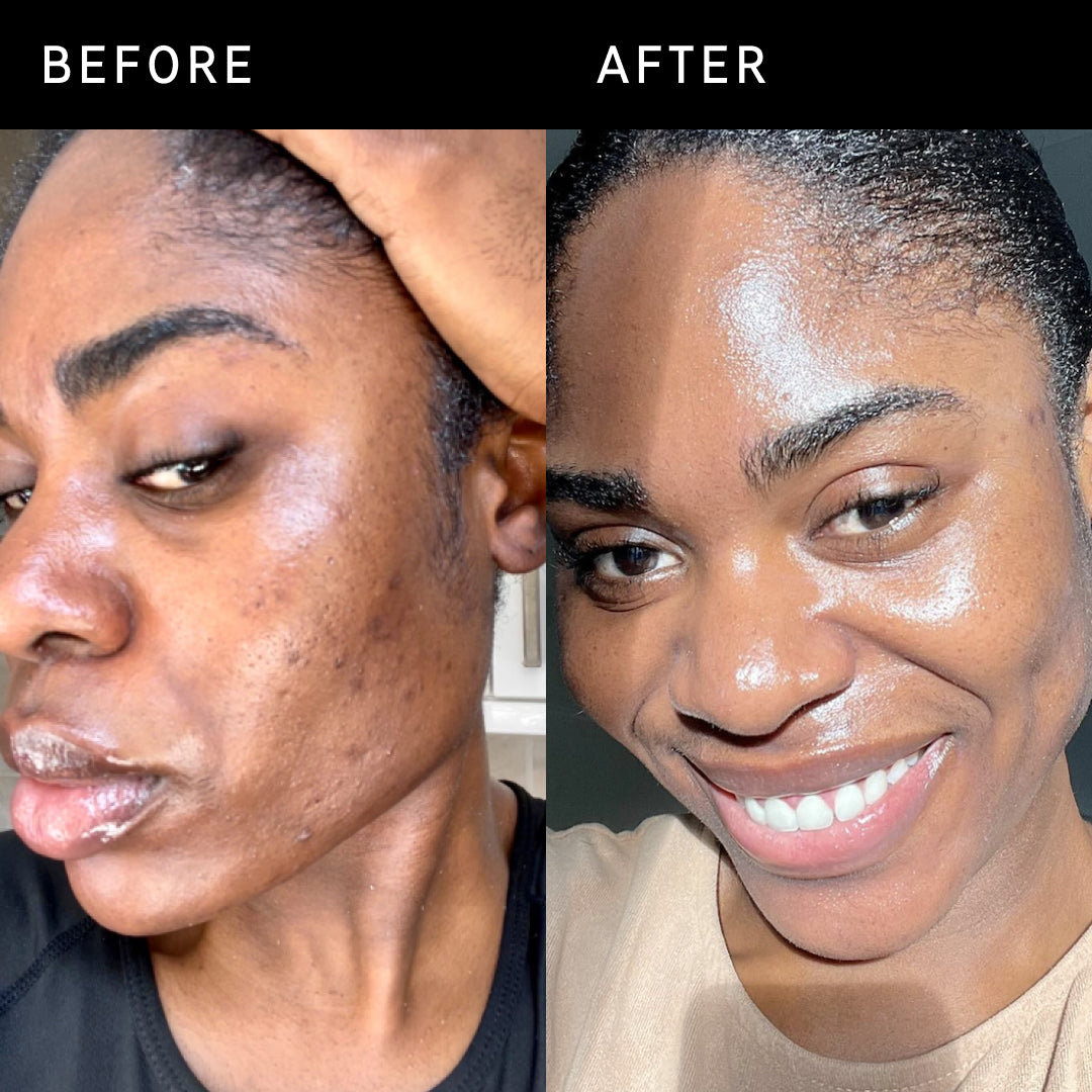 Model before and after using omega water cream