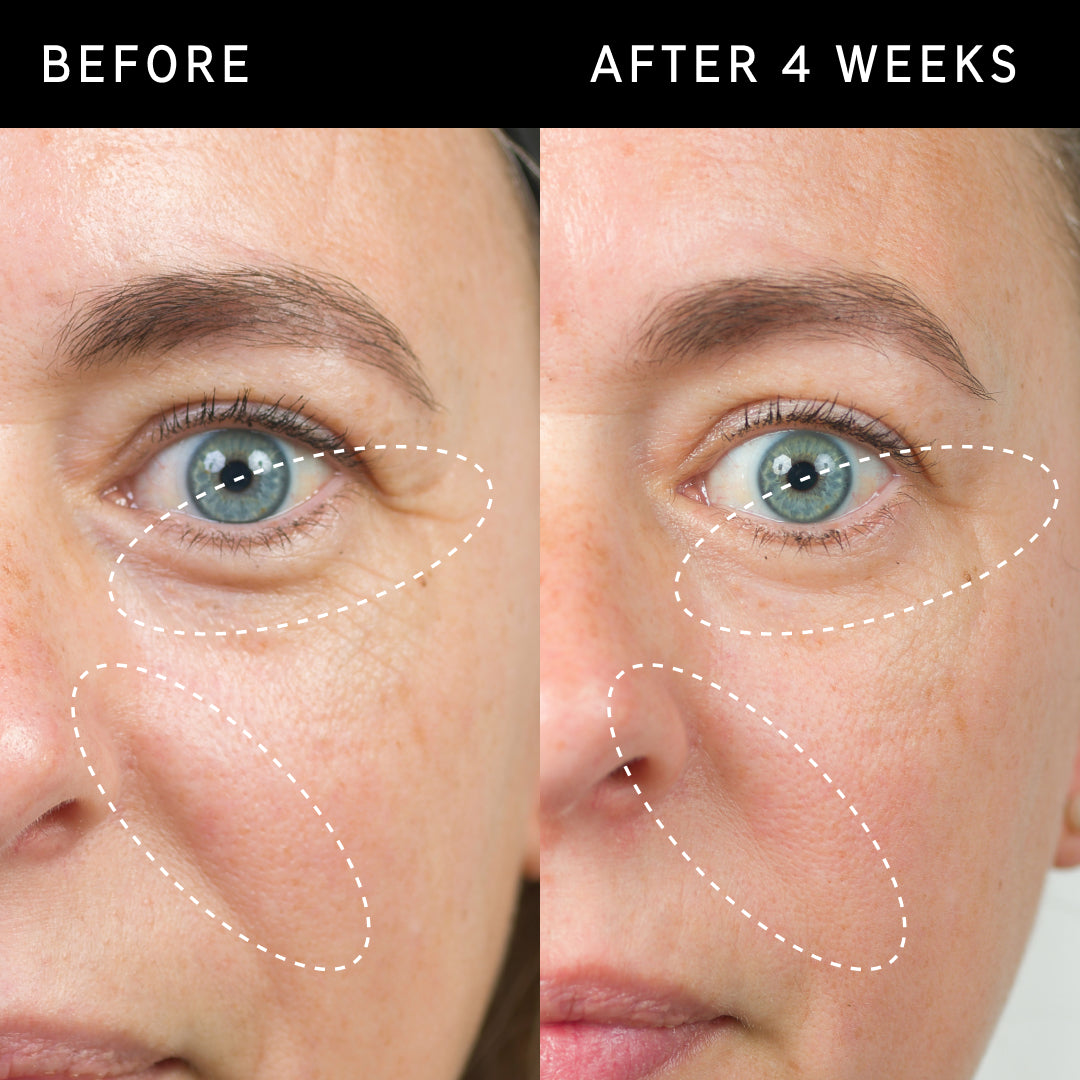 Ceramide Enriched Moisturizer to Restore & Hydrate Skin | The INKEY List EU