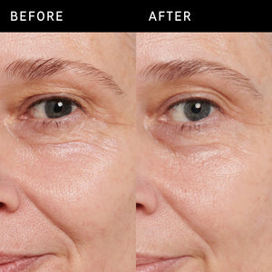 Before and after images side by side from results using Retinol Eye Cream