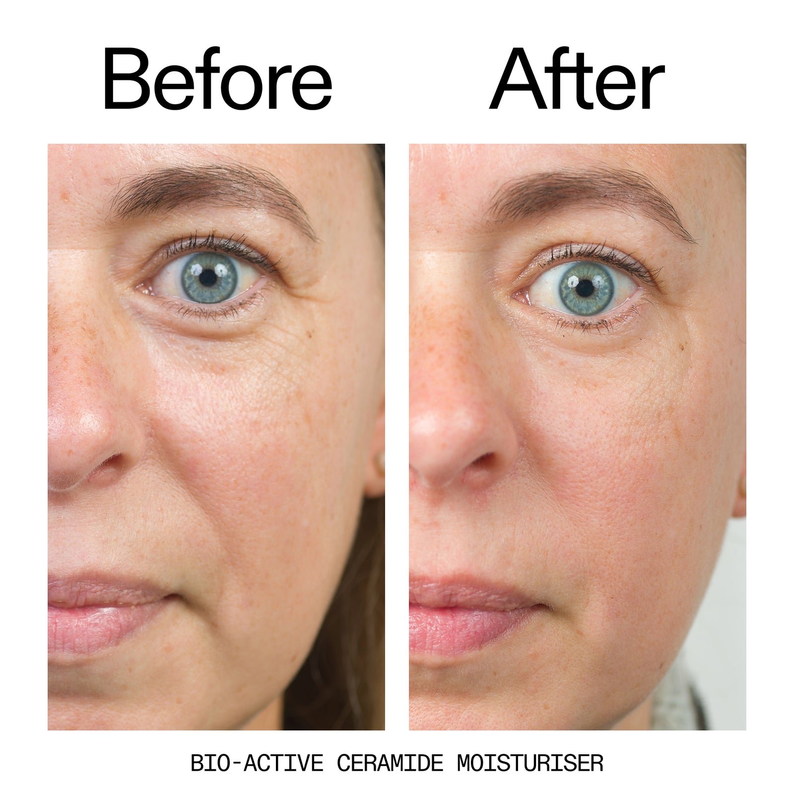 Before and after comparison of a woman's face with bio-active ceramide moisturizer.