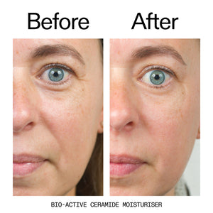 Before and after comparison of a woman's face with bio-active ceramide moisturizer.