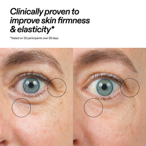 Before-and-after split screen comparison of a person's eye area, showing skin firmness and elasticity improvement. The left side shows wrinkles circled in black, and the right side shows the same wrinkles reduced.