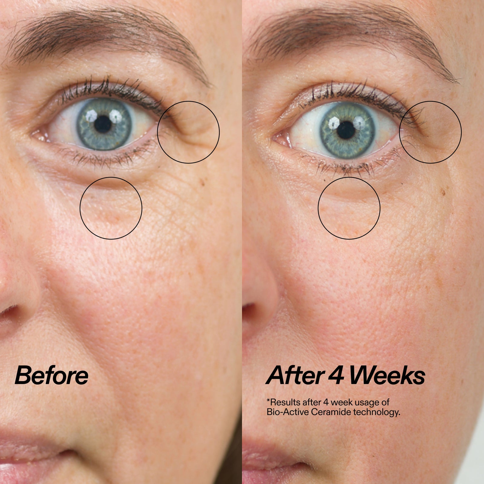 Before-and-after skincare comparison showing a close-up of a person's eye area, with wrinkles circled and text reading 'Before' and 'After 4 Weeks' on a skin background.