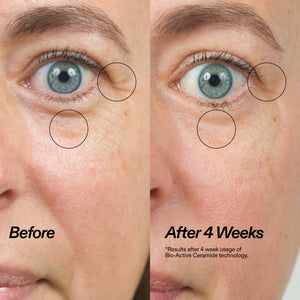 Before-and-after skincare comparison showing a close-up of a person's eye area, with wrinkles circled and text reading 'Before' and 'After 4 Weeks' on a skin background.