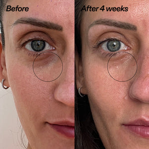 Before and after comparison of a woman's under-eye area showing improvement after 4 weeks. The left side is labeled 'Before' and shows a darker, puffy under-eye circle around the eye.