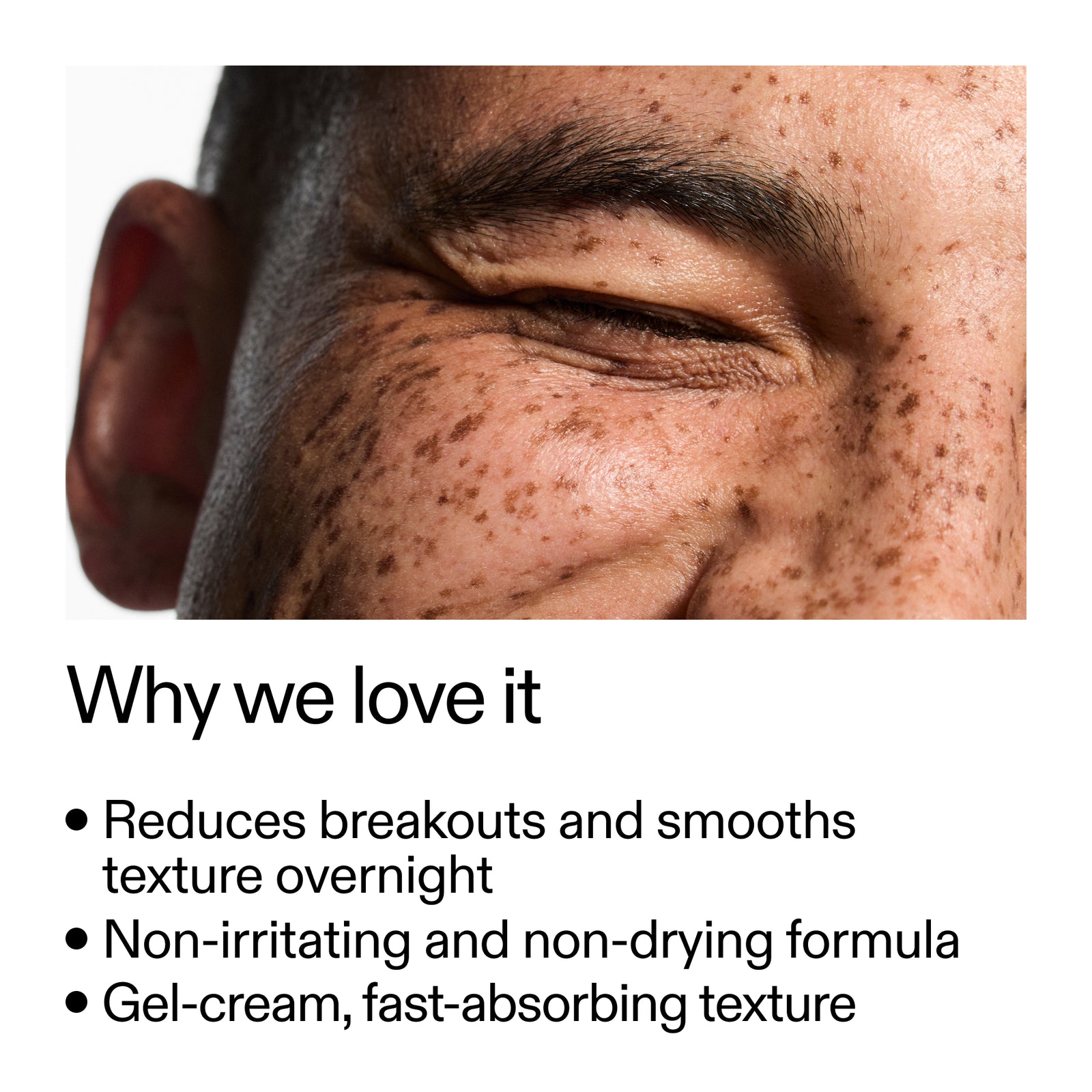 key benefits of blemish clearing moisturiser