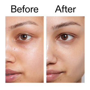 Before and after of customer using Caffeine Eye Cream