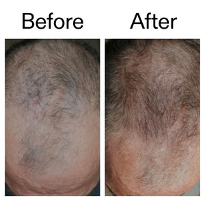 Before and after of customer using Caffeine stimulating scalp treatment