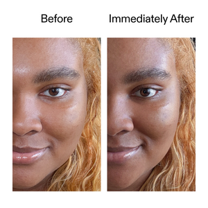 Before and immediately after using Exosome Serum