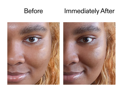 Before and after comparison of a person's face with visible skin texture differences.