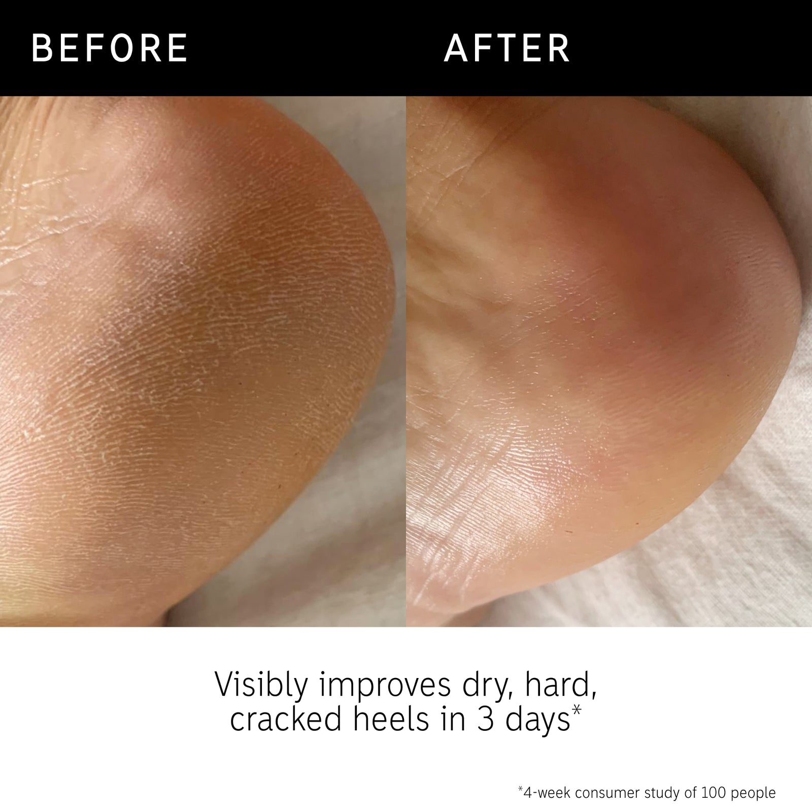 Before and after using Glycolic Body Stick and key claim from consumer study