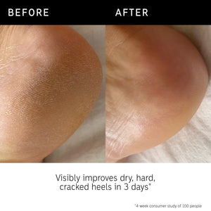 Before and after using Glycolic Body Stick and key claim from consumer study