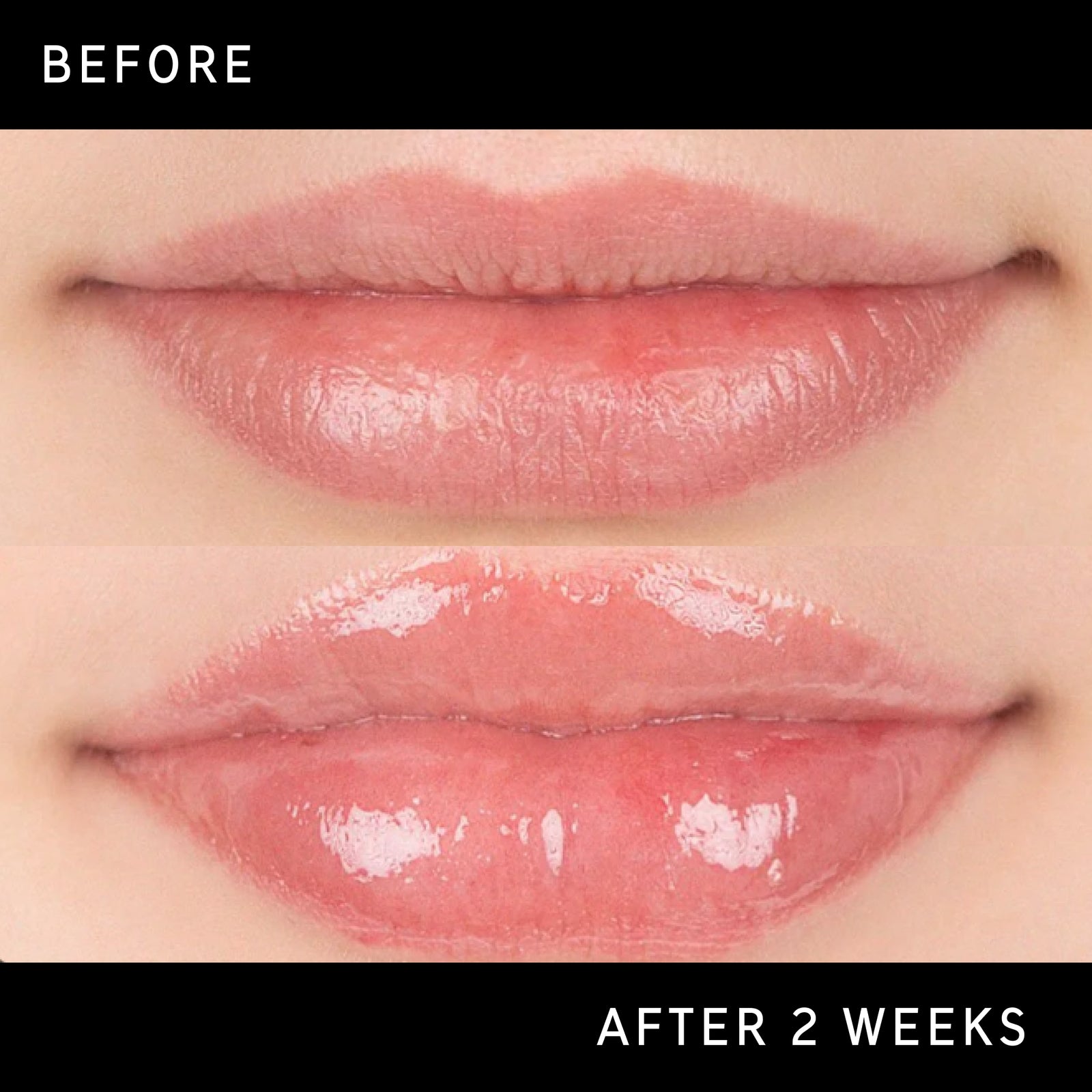 Before and after comparison image showing visible results after 2 weeks of using Tripeptide Plumping Lip Balm