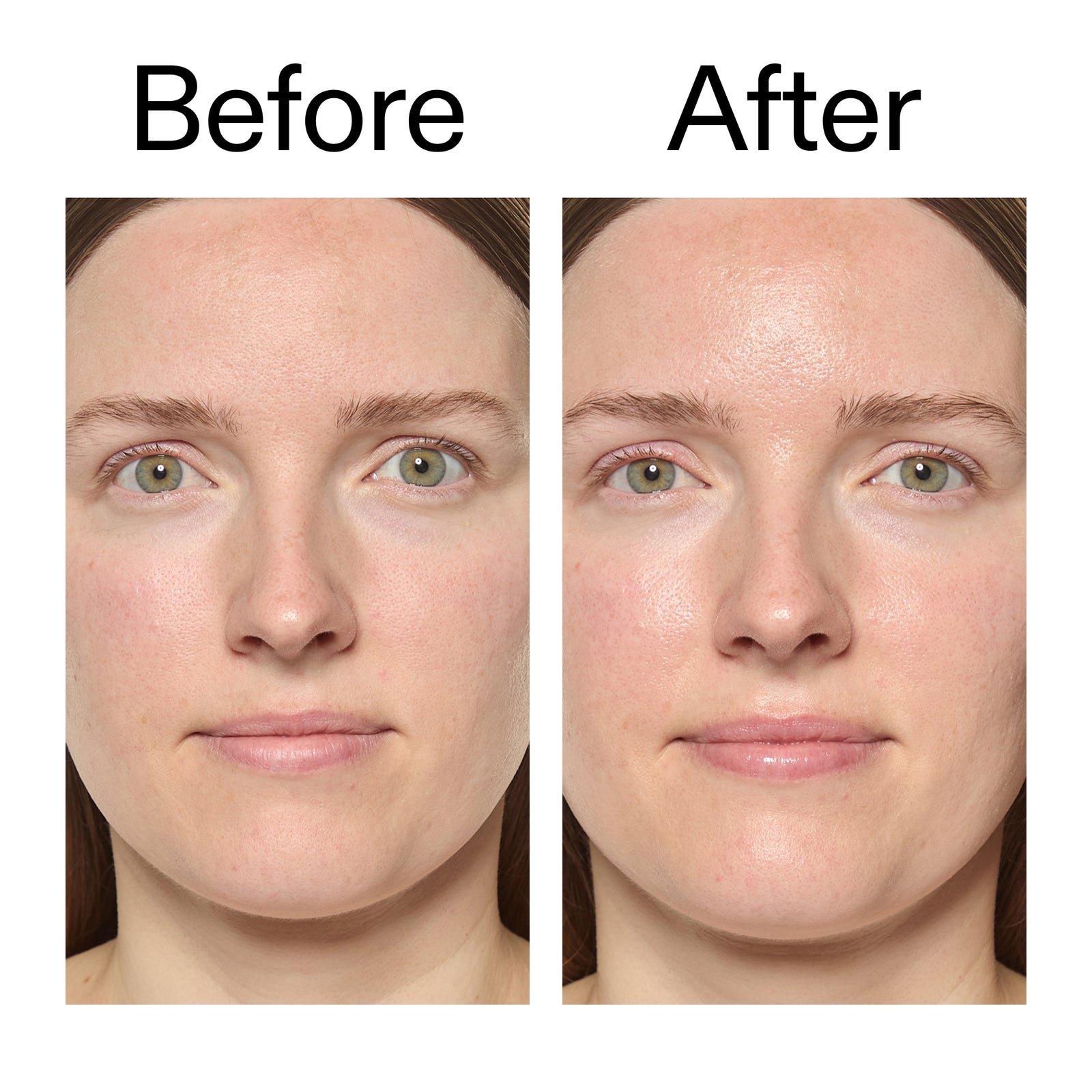 Before and after comparison of a woman's face with visible skin texture differences after using Exosome Hydro-Glow Complex