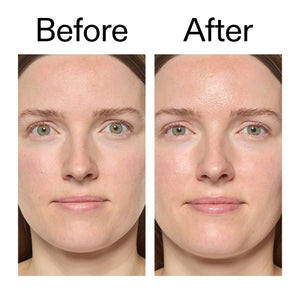 Before and after comparison of a woman's face with visible skin texture differences after using Exosome Hydro-Glow Complex