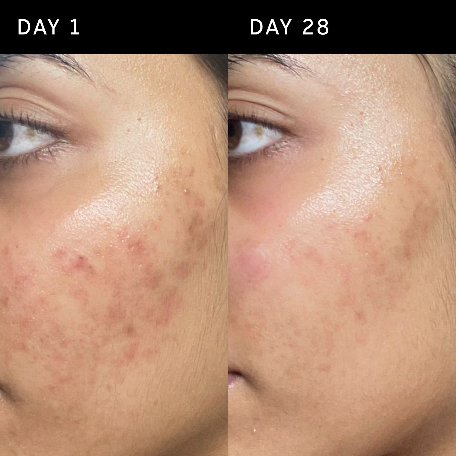 Ectoin B&A 28 days