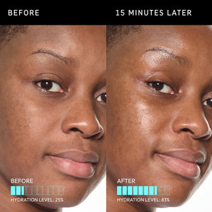 Before and after using ectoin serum 