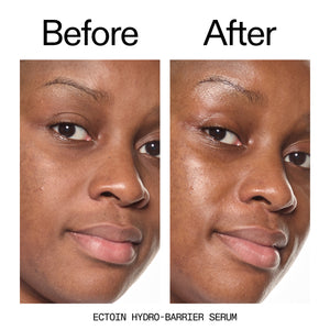Before and after comparison of a person's face with Ectoin Hydro-BARRIER Serum.