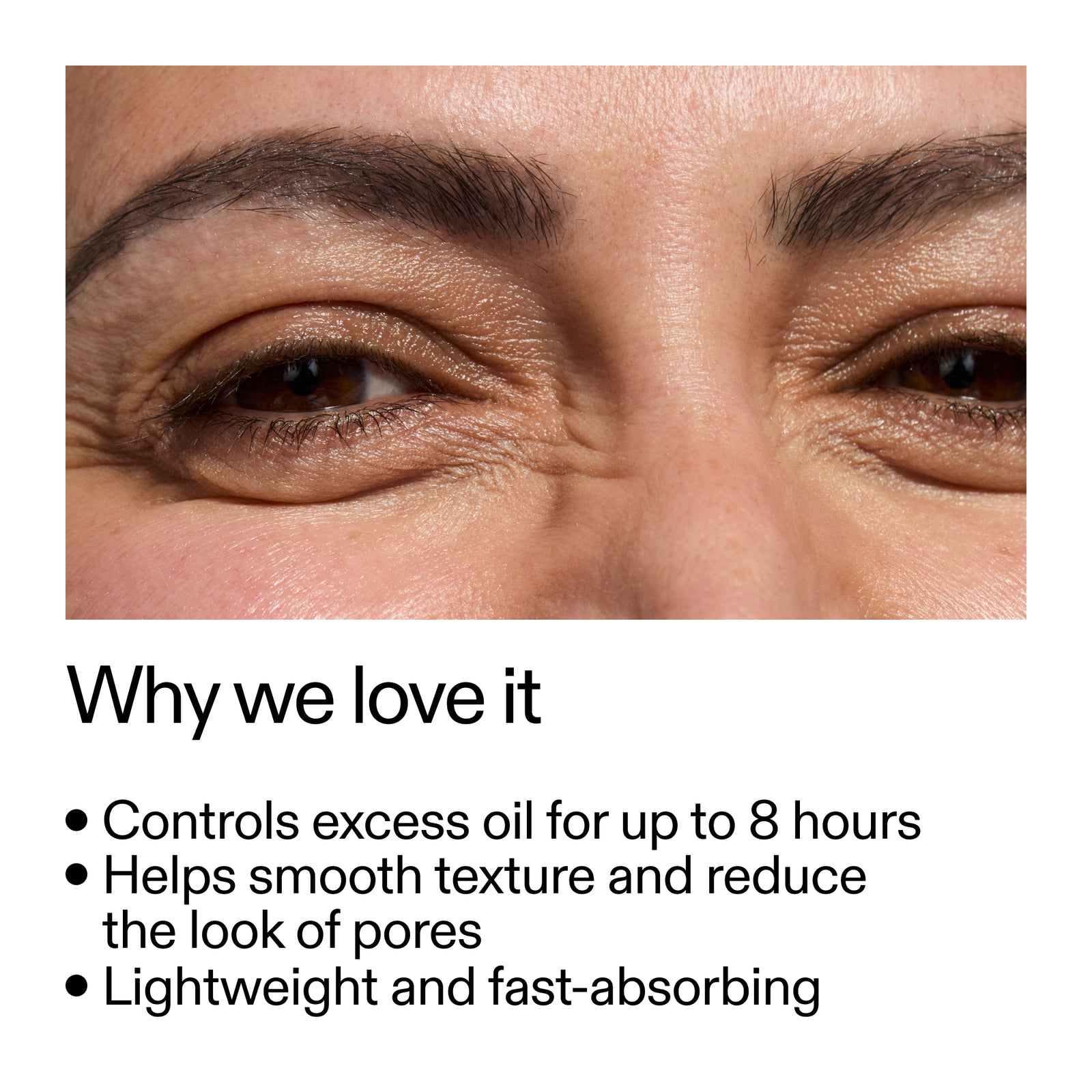 close up of someone's face and key benefits of 20% Niaciniamide