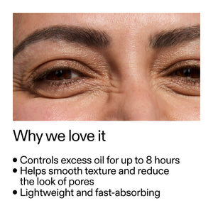 close up of someone's face and key benefits of 20% Niaciniamide