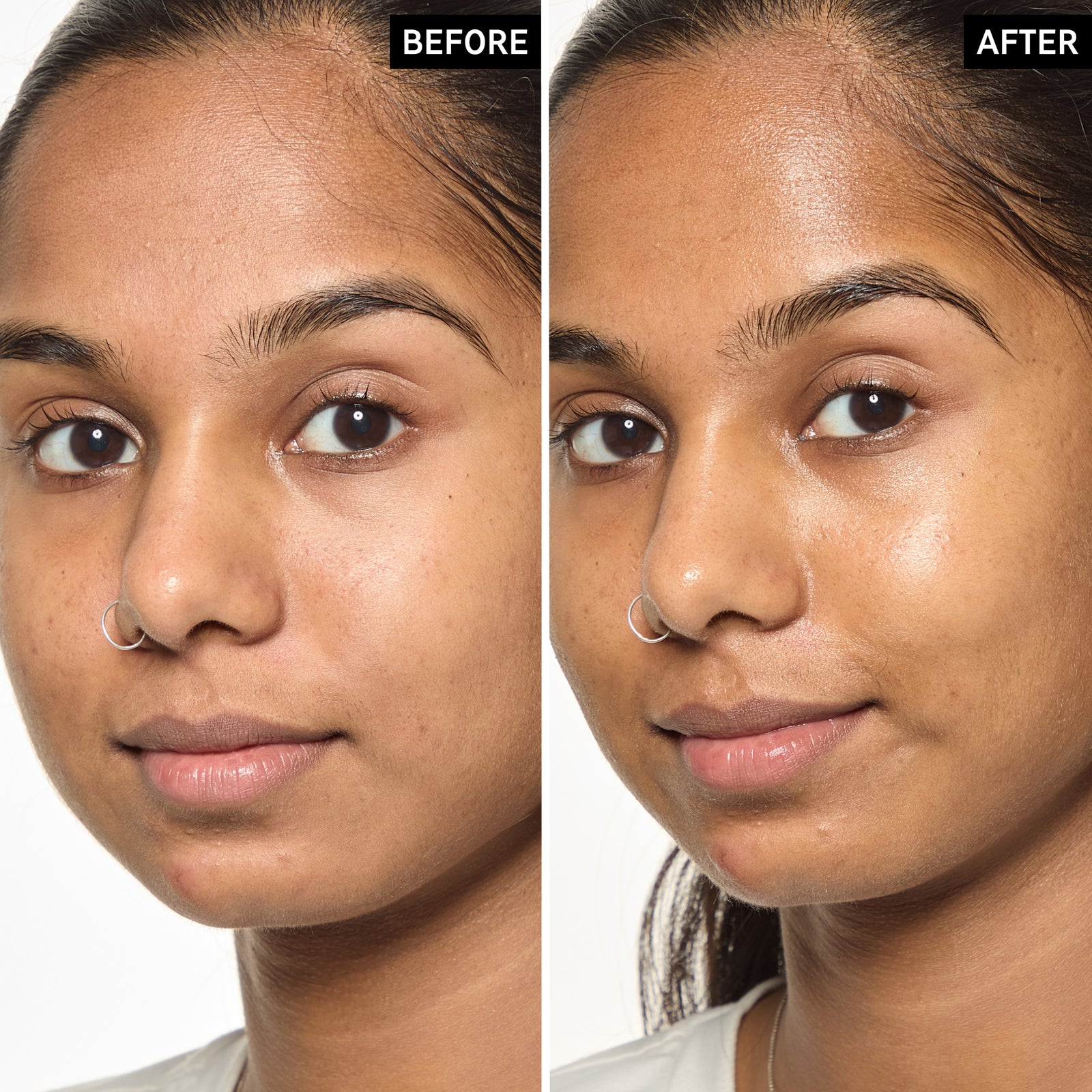 Before and after comparison of a woman's face with a visible improvement after using Exosome Hydro-Glow Complex