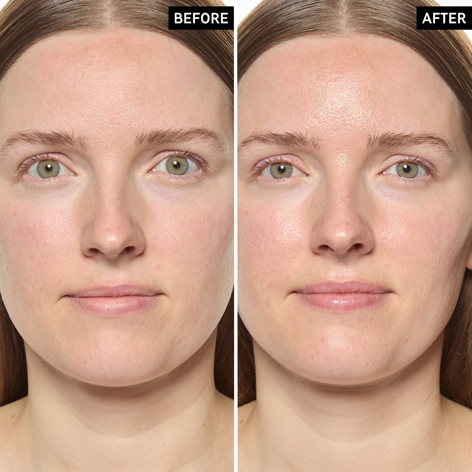 Before and after 14 days showing glowing smooth skin