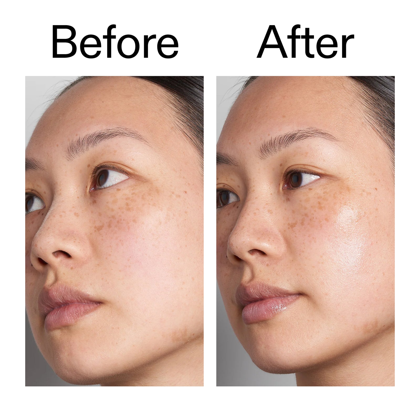 Before and after of customer using Hyaluronic Acid Serum