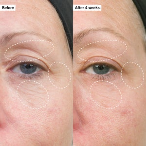 Before and after images to show Bio-Active Ceramide Repairing and Plumping Moisturizer results after 4 weeks