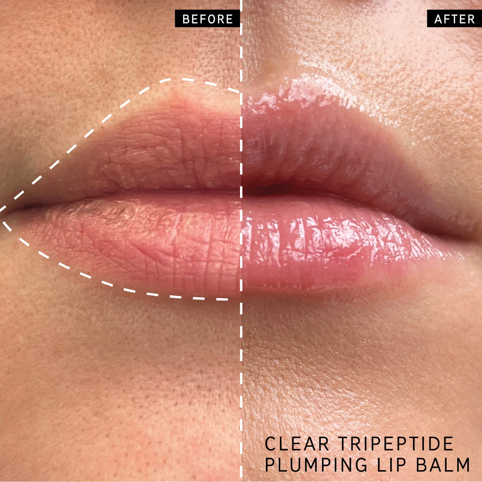 Before and after of customer using Tripeptide Plumping Lip Balm