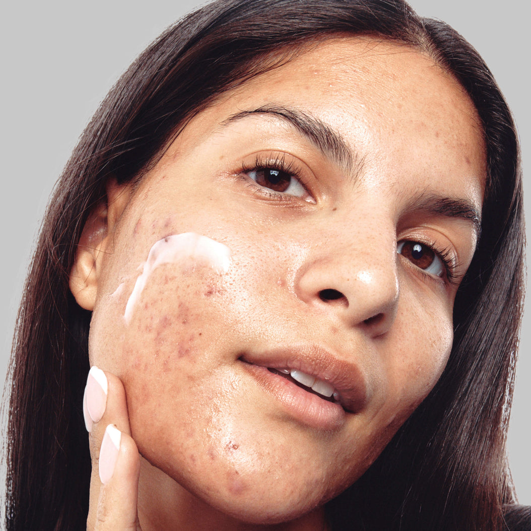 SuperSolutions | Developed With Dermatologists | The INKEY List