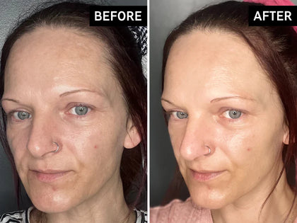 Before after using Bio Active moisturiser