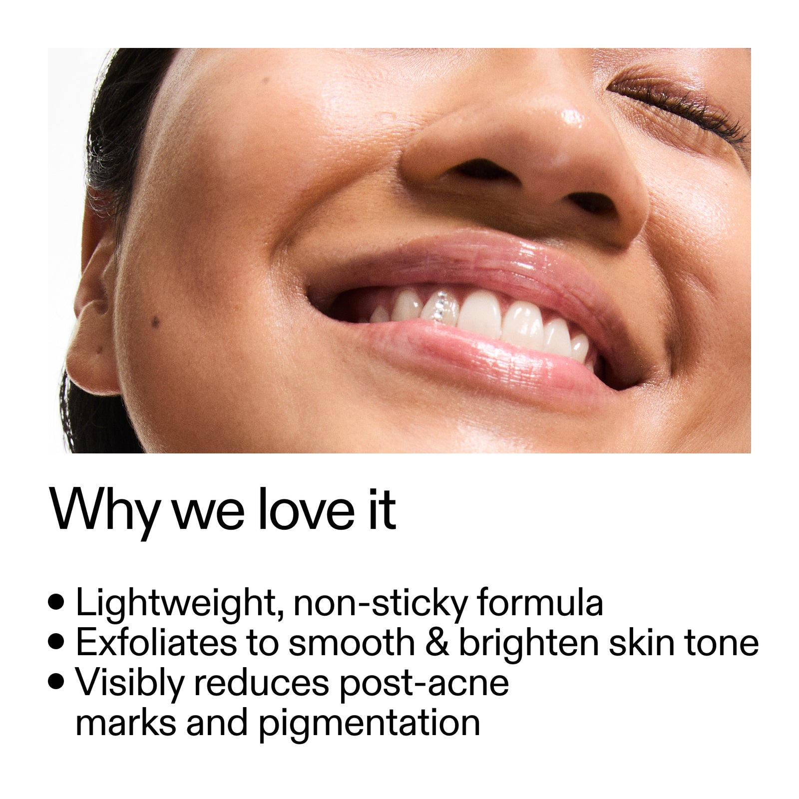 Close-up of a smiling person's face with text highlighting Mandelic Acid Treatment benefits.