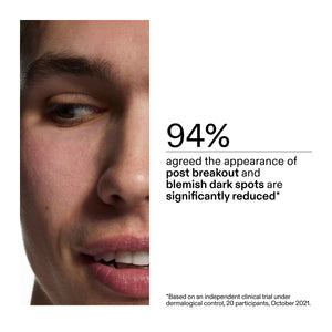 Close-up of a person's face with text about dark spot reduction from using Mandelic Acid Treatment, on a white background.