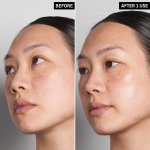 Before and after 1 use of HA Serum, showing plumper skin