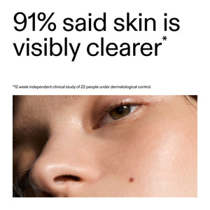 Close-up of a person's eye with text indicating skin clarity improvement using Blemish Clearing Moisturizer with 2% Novoretin